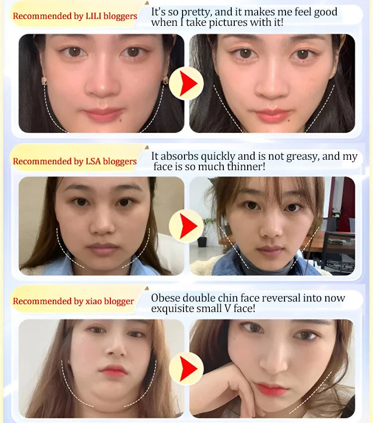 🔥Hot Sale🔥💁♀️face slimming mask🙆♀️ 🚚Cash on delivery